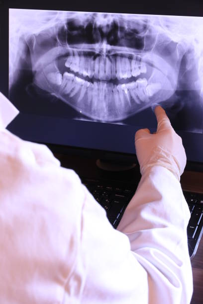 Best Emergency Treatment for Oral Infections in Paloma Creek, TX